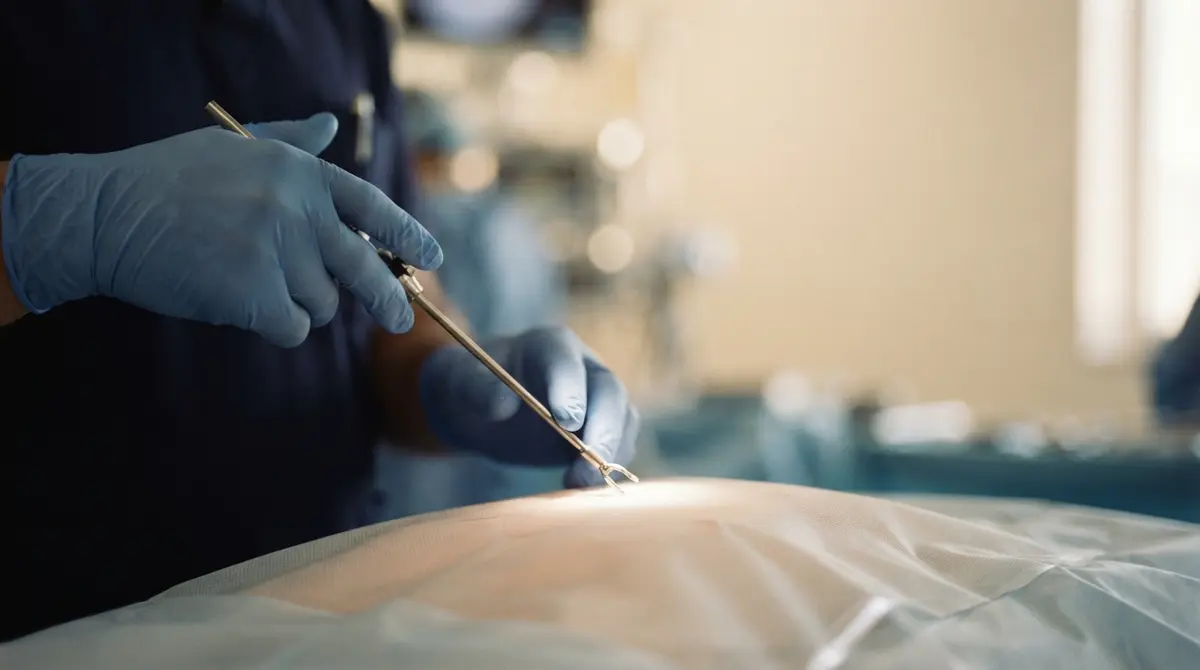 Minimally Invasive Surgery: What is Laparoscopic Surgery and How is it Performed?