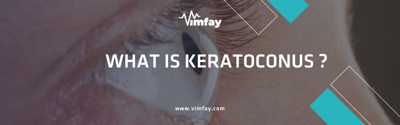 What Is Keratoconus Vimfay