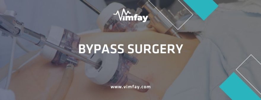 Bypass surgery vimfay