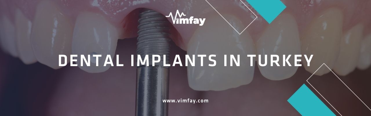 Dental Implants In Turkey Vimfay