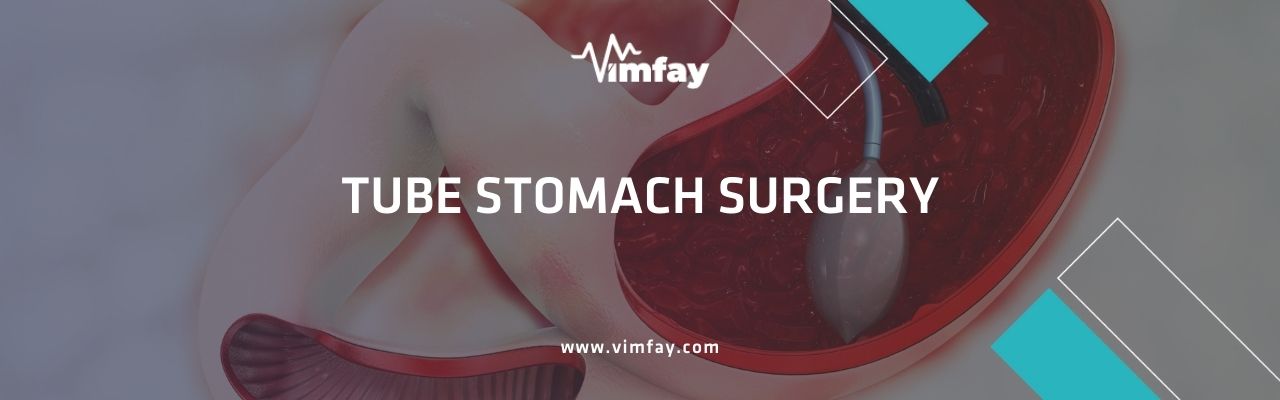 Tube Stomach Surgery