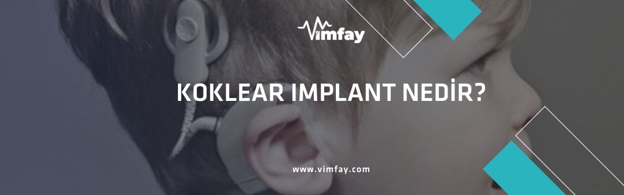 Koklear İmplant Nedir ?&Nbsp; 1 Koklear Implant Vimmfay