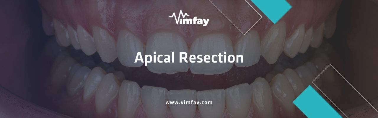 Apical Resection