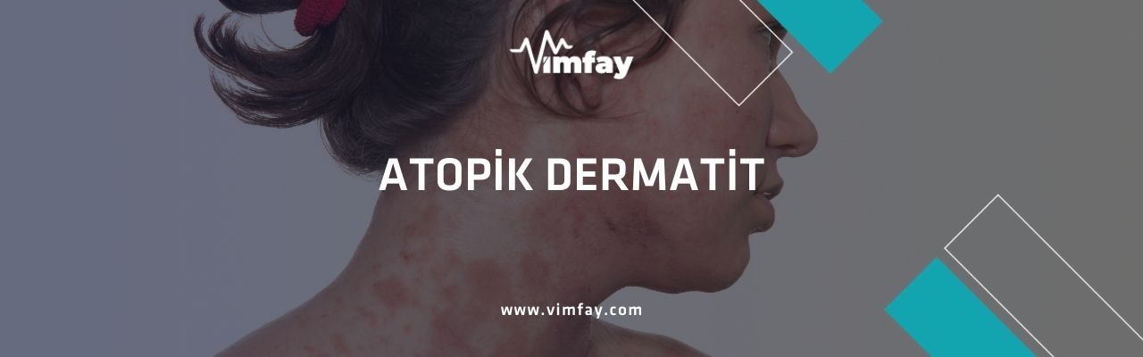 Atopik Dermatit Nedir, Belirtileri Ve Türkiye'De Atopik Dermatit Tedavisi