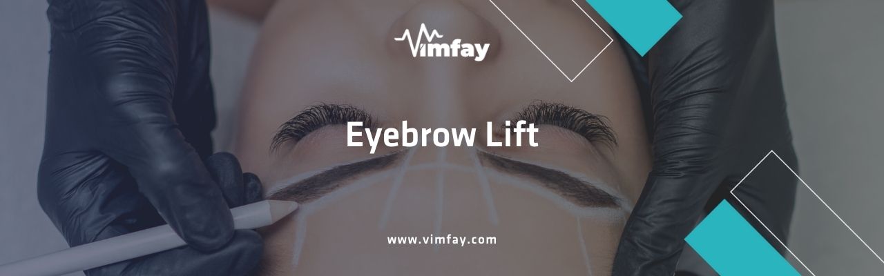 Eyebrow Lift