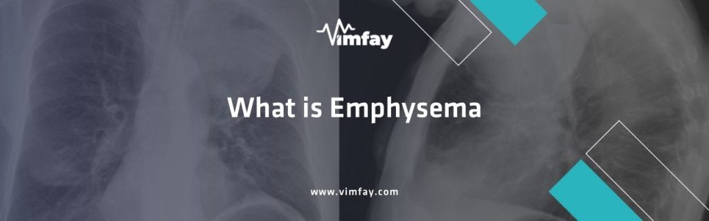 What is Emphysema