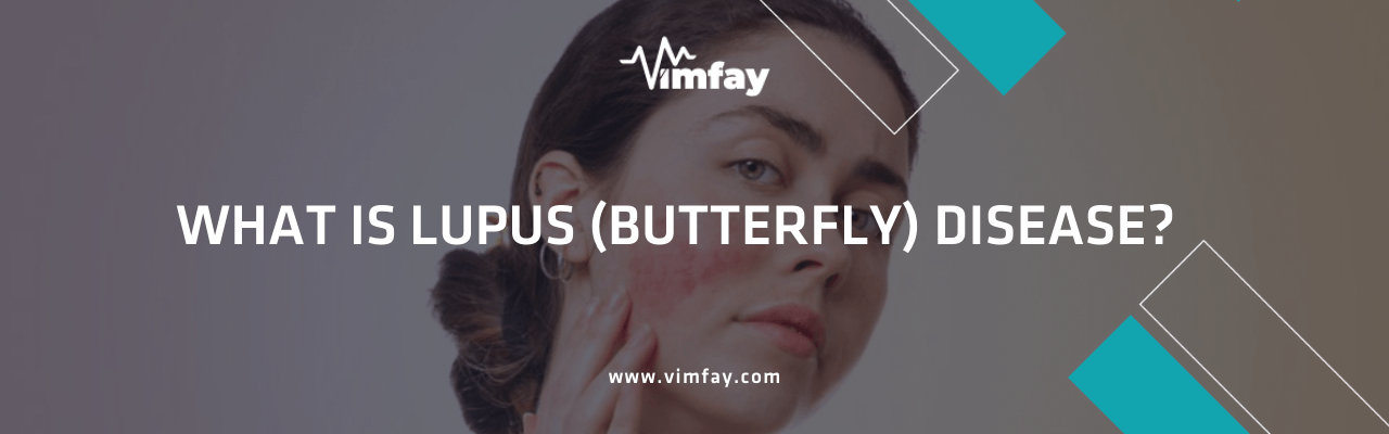 What Is Lupus (Butterfly) Dısease