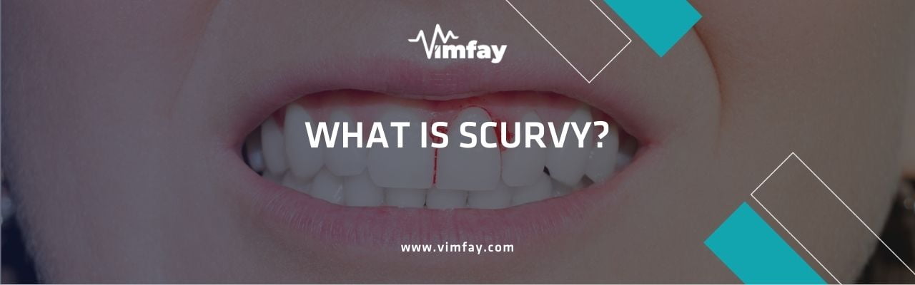 What Is Scurvy?