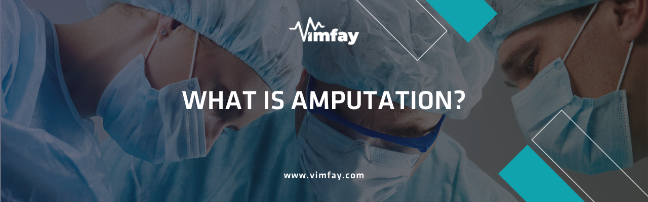 What Is Amputation