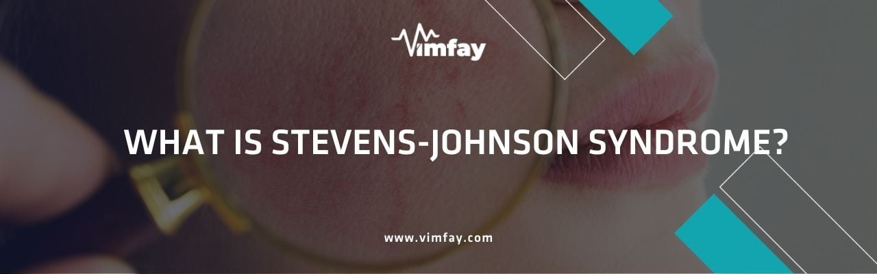 What Is Stevens-Johnson Syndrome