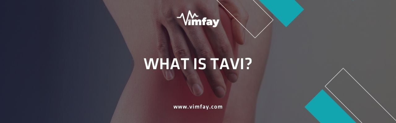 What Is Tavi