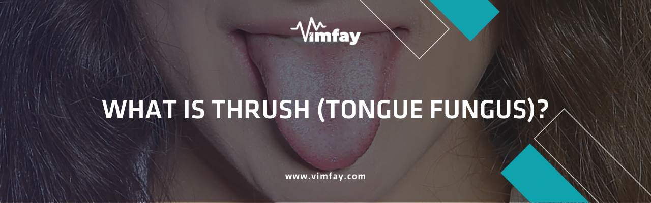 What Is Thrush (Tongue Fungus)