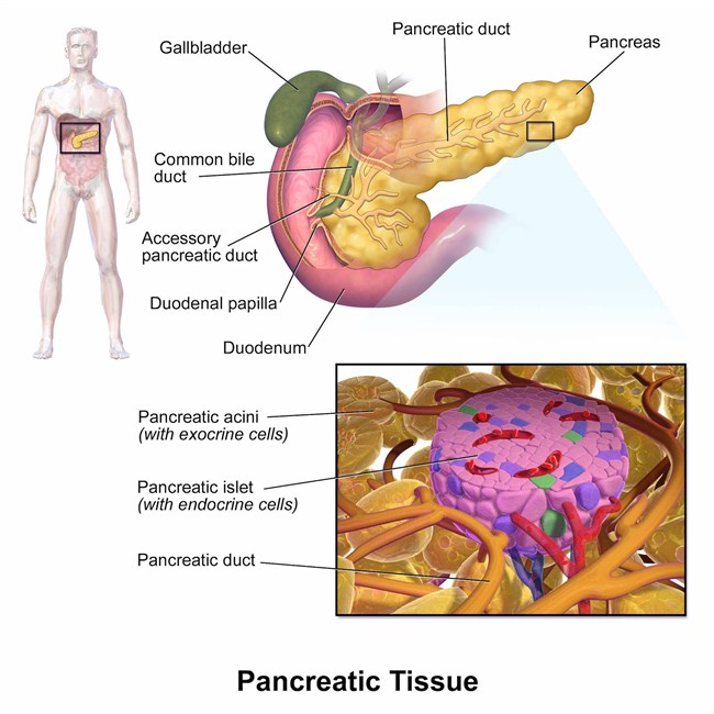 Pancreas Transplant, Pancreas Transplant Process In Turkey 2023 2