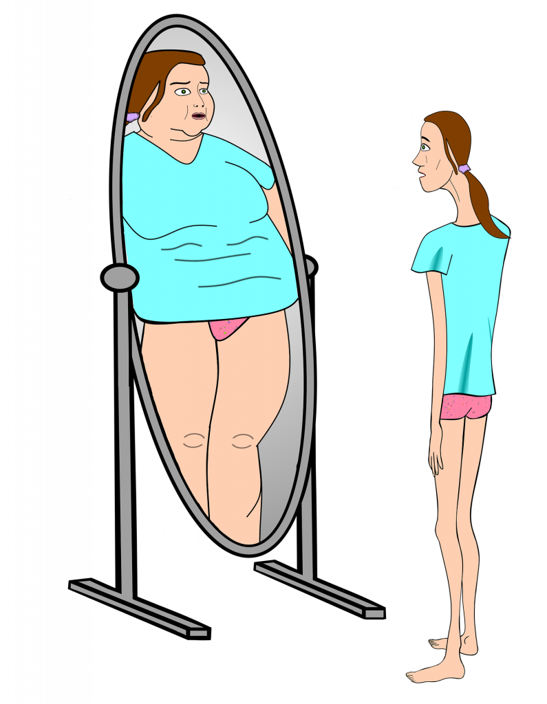 What Is Anorexia?, Symptoms And Treatment In Turkey 2023 2 Bulimia 4049661 1920 795X1024 1