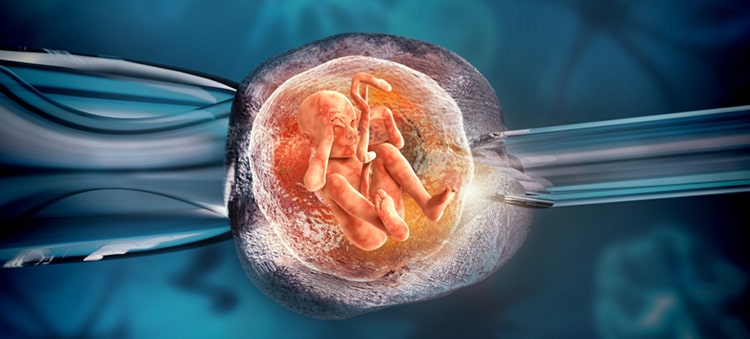 Infertility Treatment In Turkey 2023 4 Ivf 750 Min