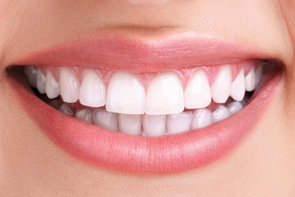Apical Resection Treatment And Prices In Turkey 2023 10 Teeth Whitening After 1