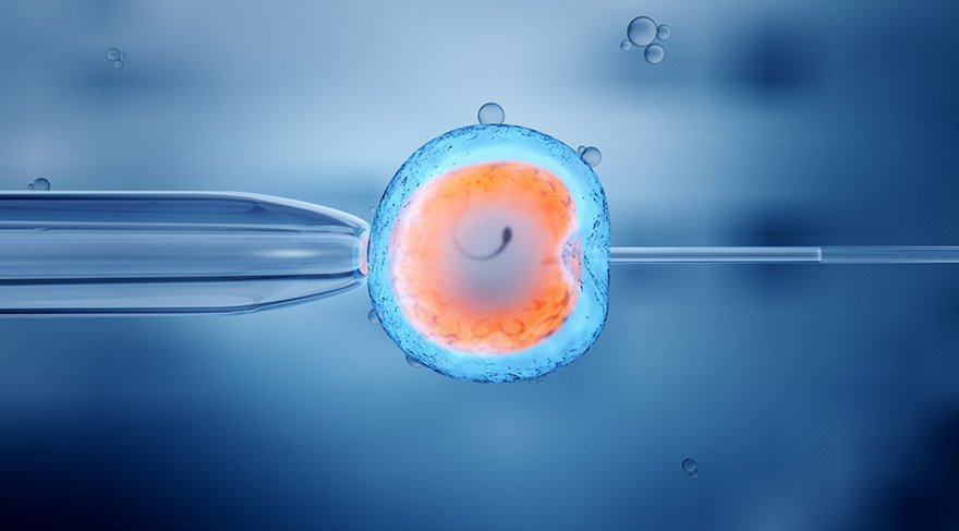 Infertility Treatment In Turkey 2023 6 Tup Bebek