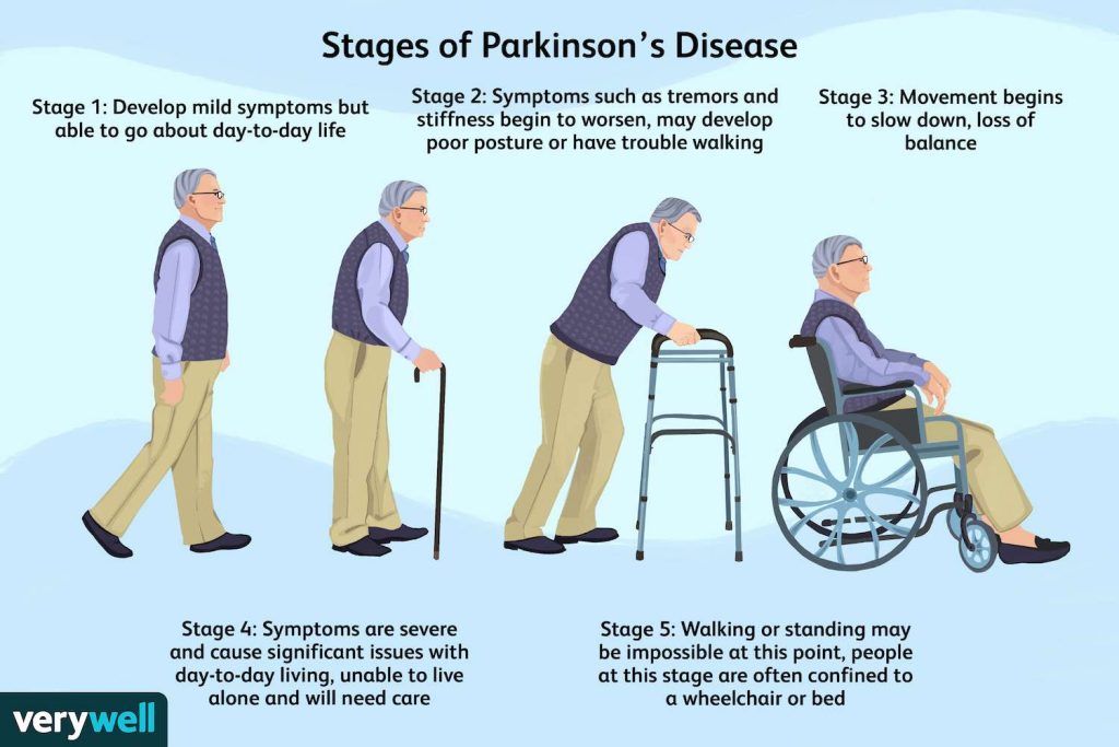 What Is Parkinson'S?, Parkinson'S Disease Cost In Turkey 2023 10 Zhansen 5200700 Finaledit2 3E7Eb00F1Bdb4806Adb3F67Ca4404894