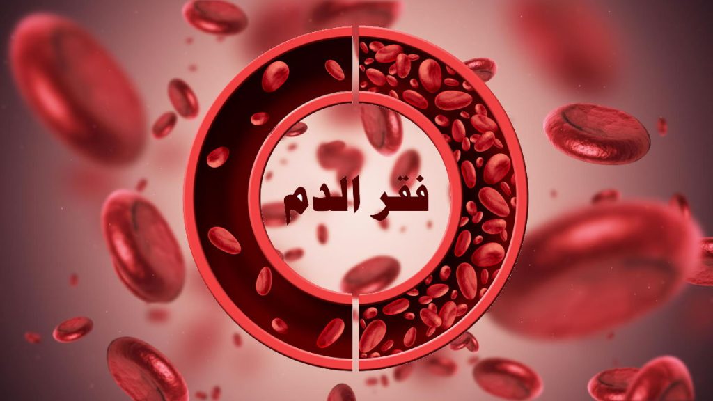 ما هو فقر الدم اللاتنسجي؟, أسعار علاج فقر الدم اللاتنسجي في تركيا 11 فقر الدم