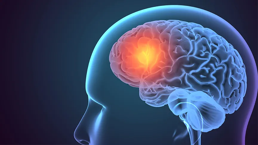 ما هي بطارية الدماغ (التحفيز العميق للدماغ في مرض باركنسون)؟ 21 Beyin Pili Nedir 3520