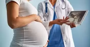 كيف يتم إجراء حساب الحمل؟ 19 Images 6
